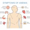 Anemia01