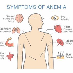 Anemia01
